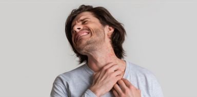 A man scratching a red rash on his neck.